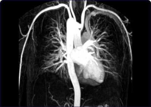 diagnos